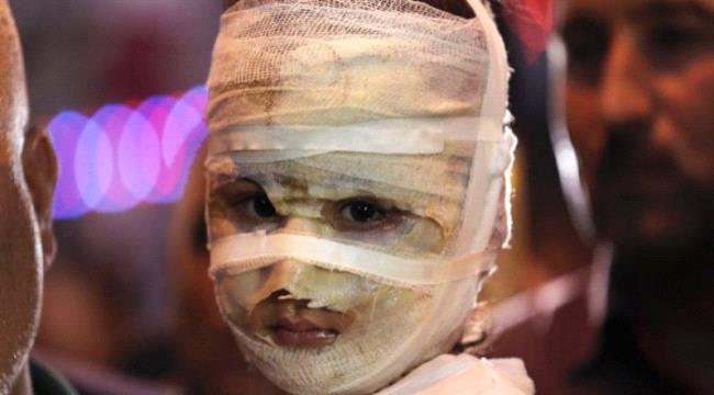 فيديو مؤلم لجرائم #الحـوثيين بحق أطفال #الحـديدة