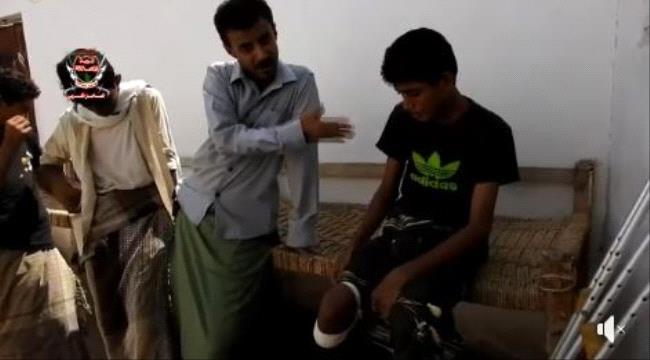 ضحايا ألغام #الحـوثي جراح مفتوحة وقصة عذاب لا تنتهي - #فيديو