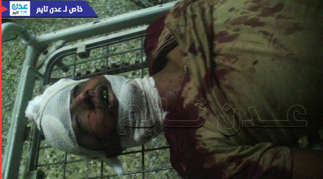 مقتل مواطن وإصابة 4 آخرين برصاص مجهولين في #لحج "أسماء"