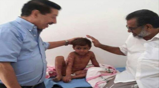 يرقد في مستشفى بابل ..طفل يعاني تقرحات بجسده بحاجة الى مد يد العون "صورة"