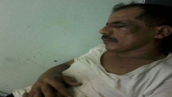 الصحفي ناصر القاضي يشكو تعرضه لاعتداء مميت بعد اقتحام منزله