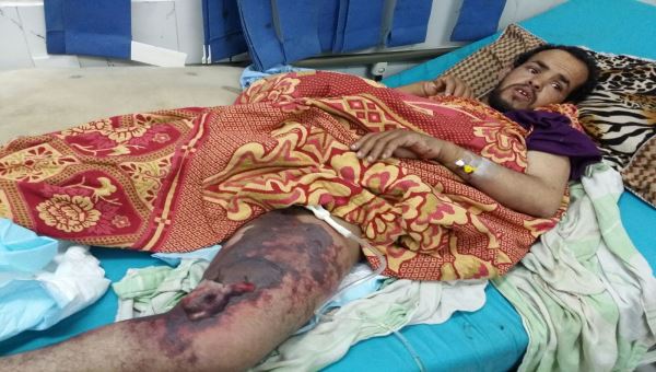  دخل مستشفى الشعيب بغرض إجراء فحوصات روتينية فخرج منها إلى العناية المركزة بعدن !!