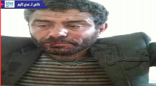 صورة.. قيادي حوثي في قبضة الجيش الوطني