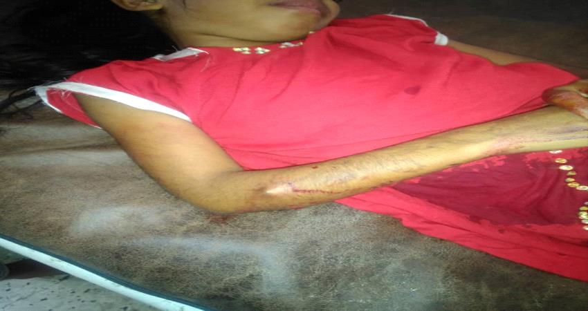 إصابة طفلة  بطلق نار عشوائي في طور الباحة 