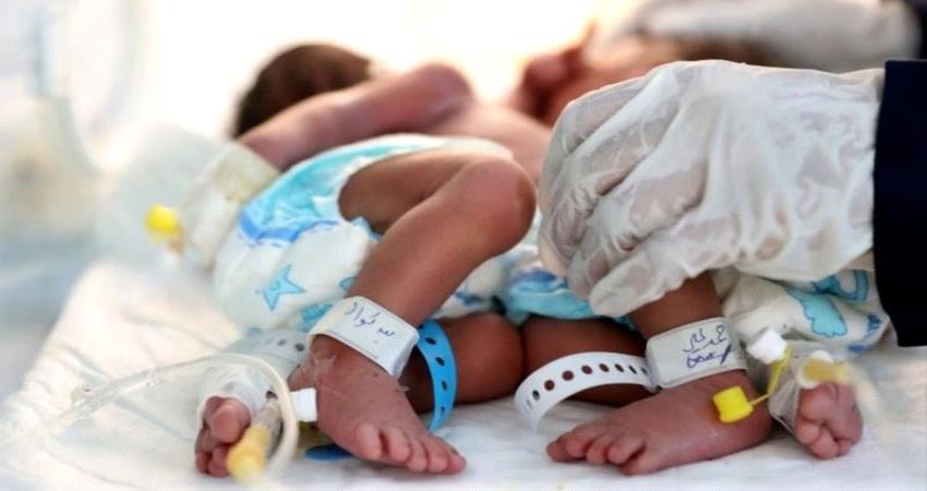  نداء لإنقاذ توأمين ملتصقين "في حالة حرجة" بصنعاء