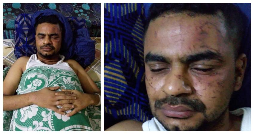 مراسل إرم نيوز " أشرف خليفة " ينجو من تفجيرات مطار عدن