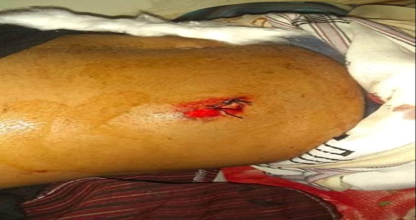 اصابة شخصين بمقذوفات من مخلفات مليشيا الحوثي جنوبي تعز