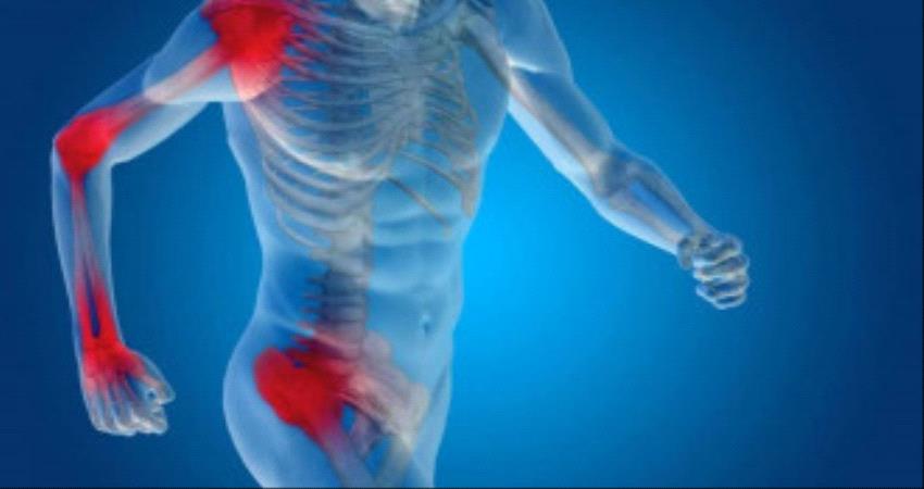 هذه أهم علاجات طبيعية للسيطرة على آلام التهاب المفاصل وهشاشة العظام