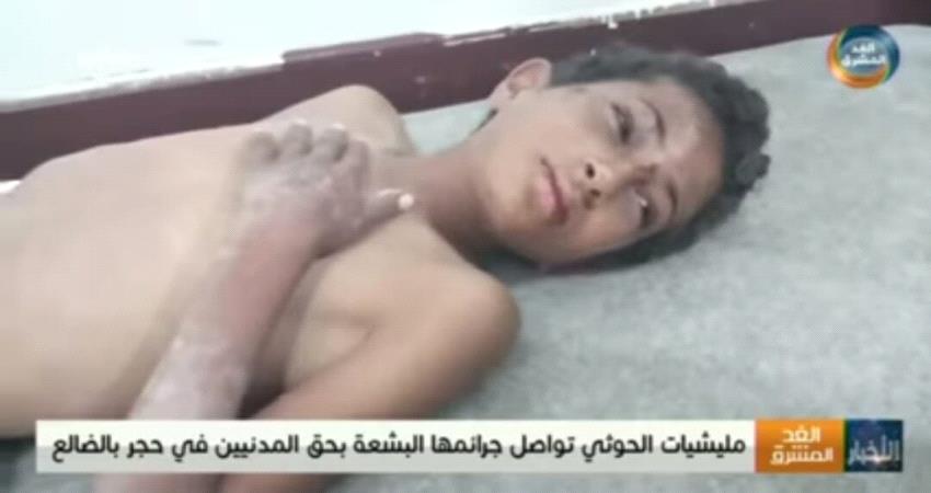 الحوثيون يرقصون على جثث البسطاء في الضالع 