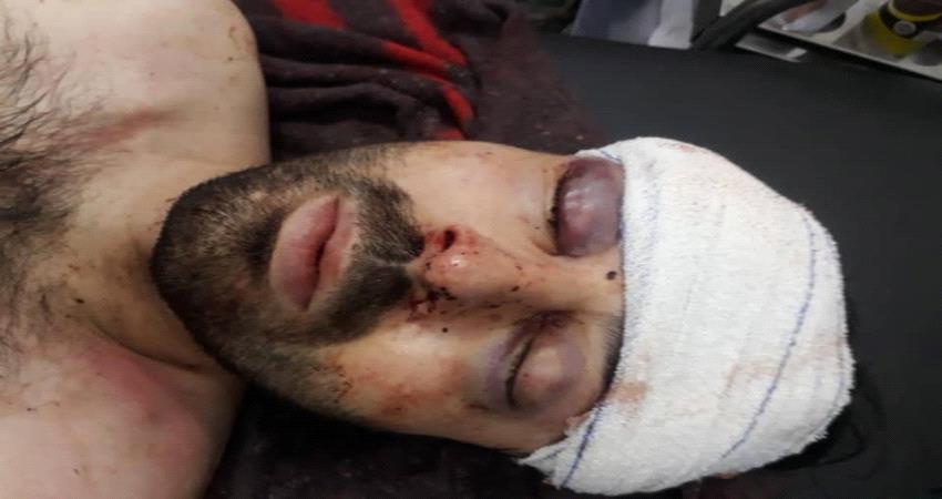 العثور على مواطن تركي مصابا بطلق ناري شمال عدن