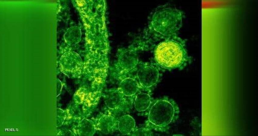 استنفار صحي في العراق بعد ظهور مرض الجمرة الخبيثة 