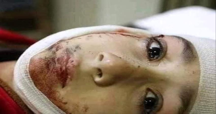 محرقة عدن...عدو يتعطش سفك الدماء واشباع رغباته الإرهابية 