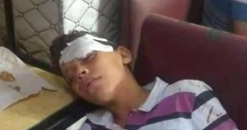 داء الكلب يتفشى  وسط تحذيرات طبية