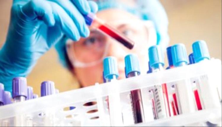 علامات تدل على الإصابة بسرطان البنكرياس