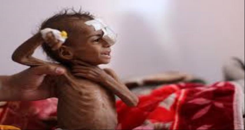مأرب تعيش مأساة إنسانية في ظل "حرب قذرة" في اليمن