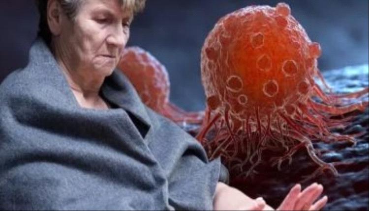 أنواع سرطان الدماغ وكيفية علاجه؟