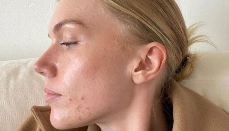 5 أعراض تحذرك من خطورة الجلوس طويلا 