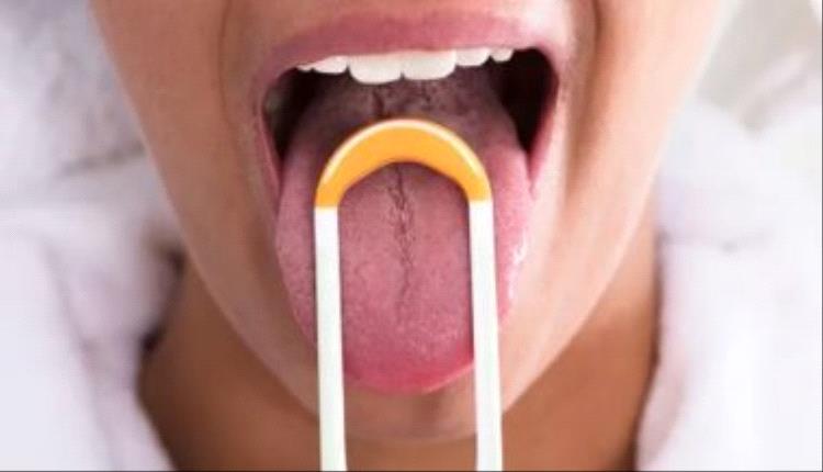 ما هو سرطان الجلد تحت اللسان؟