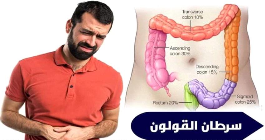 سرطان القولون والمستقيم ..مارس شهر التوعية