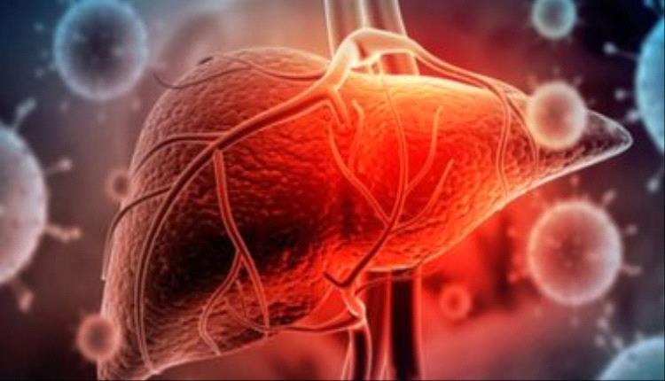 ما هى عملية زراعة الكبد؟