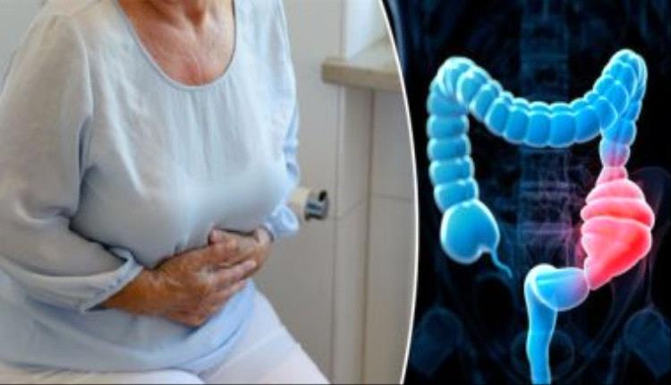 5 أطعمة ومشروبات طبيعية لعلاج الإمساك.. منها الألياف والقهوة