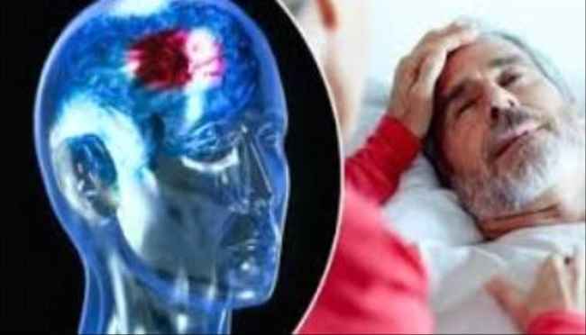 السكتات الدماغية الشتوية معظمها ناتج عن تجلط الدم