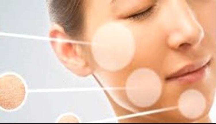 اعراض مرض البهاق  وأسبابه