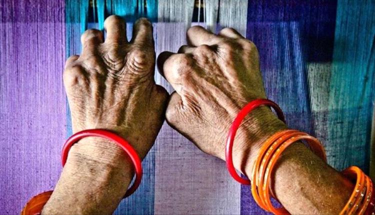 الجذام.. تعرف على الأسباب والأعراض