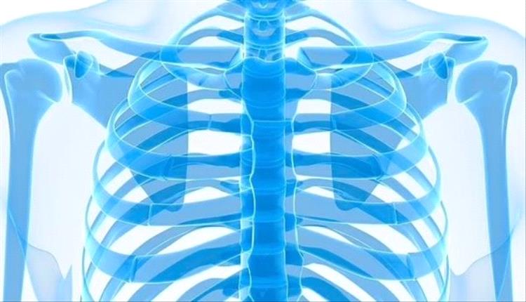بريطانيا تستخدم طابعات ثلاثية الأبعاد لإنشاء أضلاع بديلة لمرضى اورام الصدر