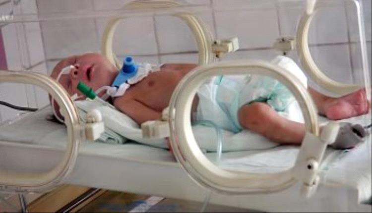 الأطفال الخدج الناجون بغزة يواجهون شبح هذه الأمراض