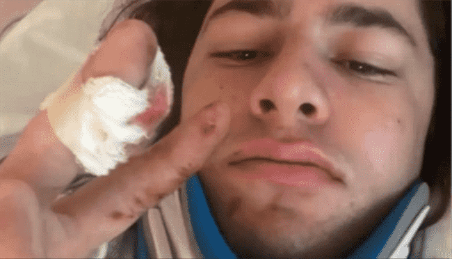 والدة أحد شبان الفلسطنيين “بولاية فيرمونت” : ابني بلا حراك وقد لا يمشي مجددا