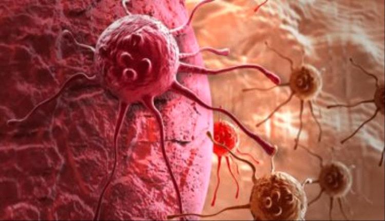 دراسة حديثة تكشف أسبابًا جديدة لانتشار السرطان بالعمود الفقرى
