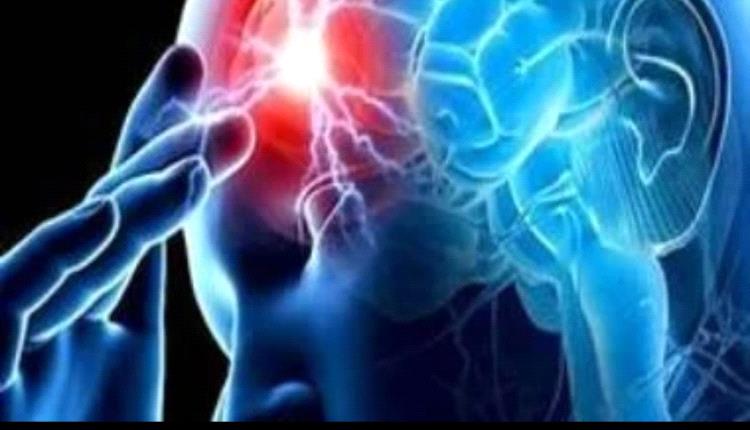 كل ما تريد معرفته عن السكتة الدماغية