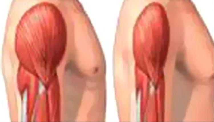 أشهر أسباب وأعراض تيبس العضلات