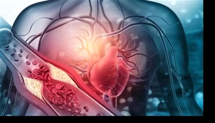 دراسة مسكنات الألم التي يتناولها الملايين مرتبطة بأمراض قلبية مميتة