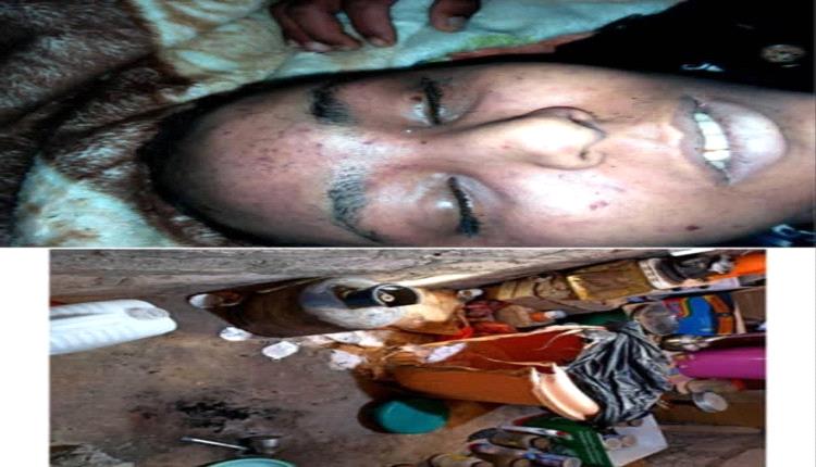 مأرب ..ملف مكشوف يختبر نزاهة القضاء وقدرته على مقاومة النفوذ العسكري والبيروقراطية المتعجلة