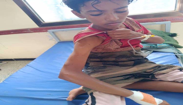 إصابة طفل بطلق ناري من قناصة مليشيا الحوثي في كرش بلحج