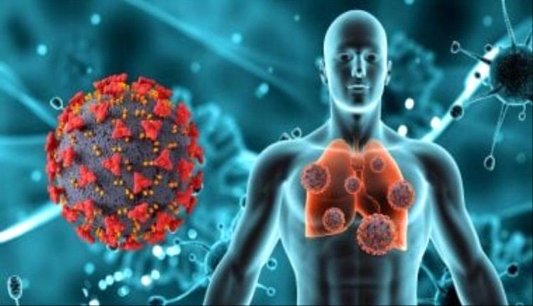 أعراض لـ سرطان الرئة تظهر على الأصابع والأظافر