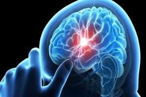 تعرف على أسباب ألزهايمر التي لا تعلمها.. ماذا يحدث داخل الدماغ؟