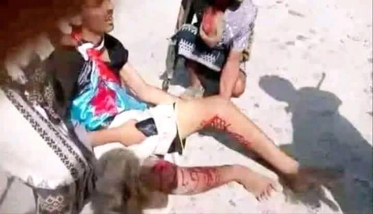 عاجل :  هجوم وحشي تشنه قوات الغزو اليمني على متظاهرين حضارم وجرحى ينزفون 