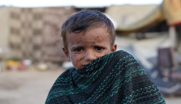 مركز حقوقي: أكثر من 2.1 مليون إصابة مرضية وانهيار 70% من المختبرات في غزة وسط حرب الإبادة