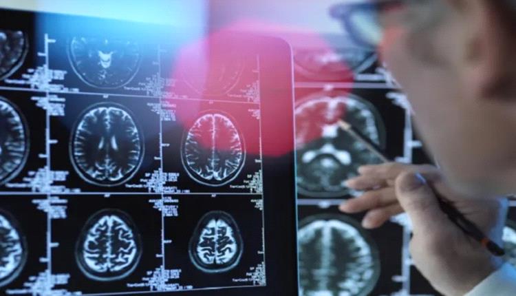 دراسة حديثة: العادات الصحية اليومية تبطئ شيخوخة الدماغ