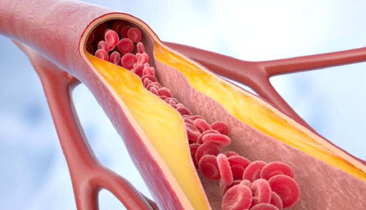 دهون في الجسم تساعد في ضبط ضغط الدم !