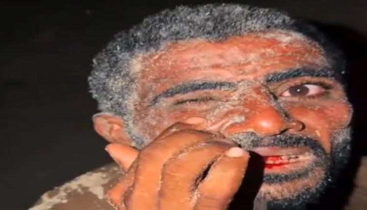 المكلا : العنف يسود مهرجان البلدة 