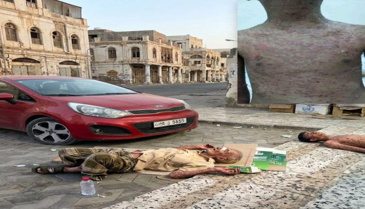 ثورة الفرشان.. أبناء الخساف في عدن يعلنون الاعتصام المفتوح احتجاجاً على تردي خدمة الكهرباء