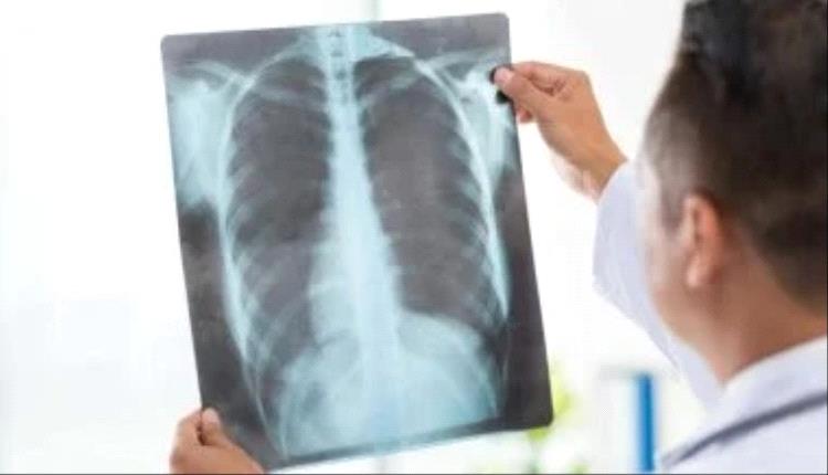 الالتهاب الرئوى.. علامات تحذيرية مبكرة قد تنقذ حياتك من عدوى خطيرة 
