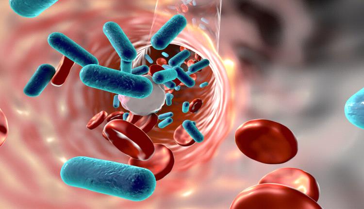 تعفن الدم...مرض مخيف لايعلمه الكثير !