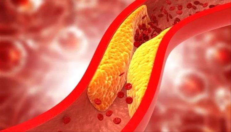 أطعمة صحية لخفض مستويات الكوليسترول.. تعرف عليها