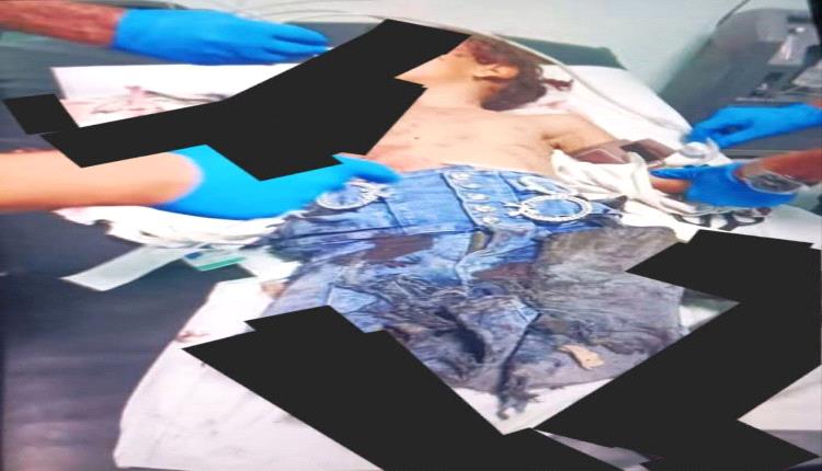 الضال: إصابة طفلة بانفجار بقايا مقذوف متفجر أثناء توجهها إلى المدرسة