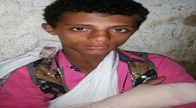 حوثيون يبترون أصابع طفل ويكسرون ذراعه في إب